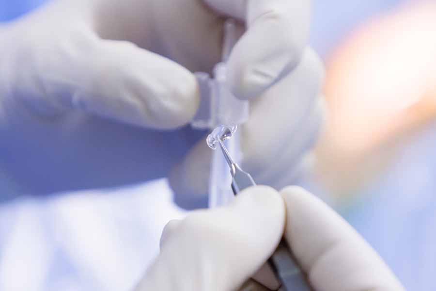 This is an artificial eye lens that is inserted into one eye to replace the natural lens.